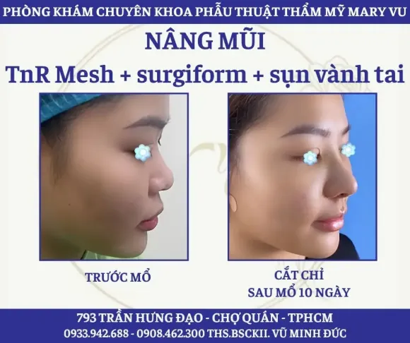 Kiến thức làm đẹp